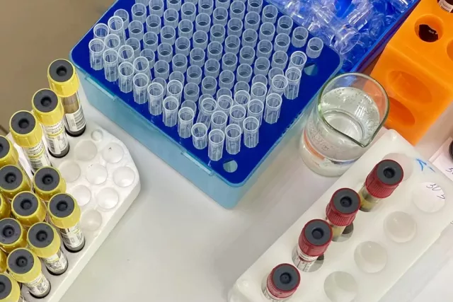 Эксперты назвали скрытые признаки болезни печени - SterlitamakTime.ru - главные новости Стерлитамака, 20.02.2026