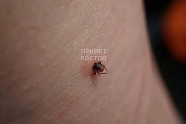 На Дону зафиксирован первый в этом году случай укуса клещом — в больницу вчера обратился житель Волгодонска - Privet-Rostov.ru, 15.03.2026