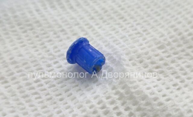 Нижегородские врачи вытащили колпачок от ручки из легких 13-летнего ребенка - Новости Нижнего Новгорода - Живем в Нижнем, 09.11.2025