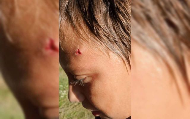 Школьник получил камнем в голову за громкую музыку в воронежском Богучаре - Обозреватель.Врн, 24.08.2026