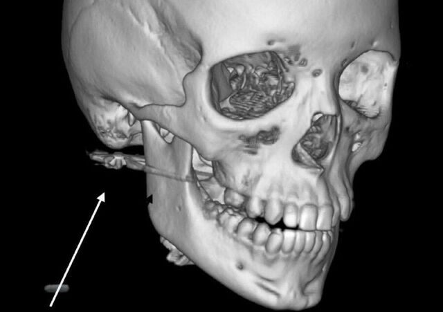 Уголовное дело против родителей завели в Приморье после ранения ребенка из винтовки - PRIMPRESS, 26.02.2026