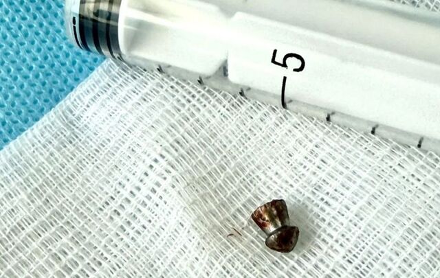 Игра с «воздушкой» обернулась пулей в лице у подростка в Приморье - PRIMPRESS, 26.02.2026