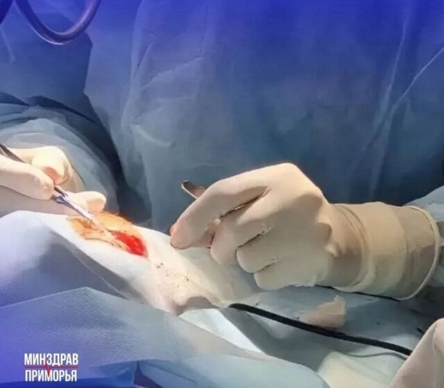 На волоске от слепоты: школьница из Приморья едва не лишилась зрения из-за пистолета - PRIMPRESS, 04.06.2026