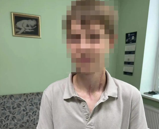 Рассекло шею до позвоночника: в Челябинске спасли юного мотоциклиста - Информационное агентство «Урал-пресс-информ», 27.07.2026