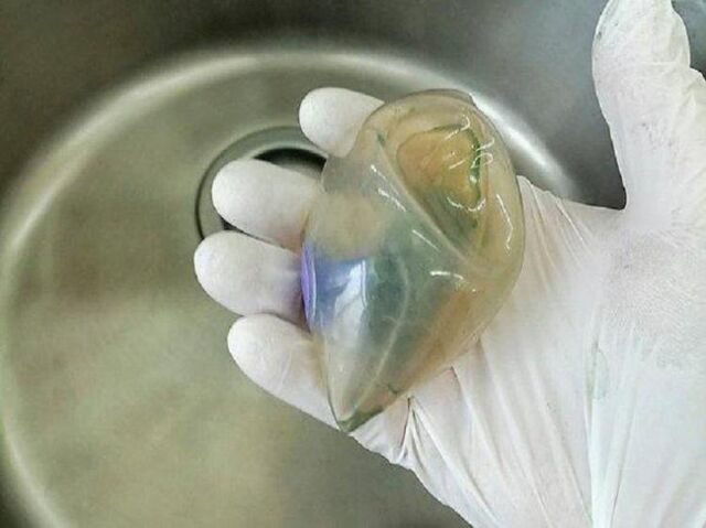 Приморчанку чуть не убил баллон для похудения - Vladnews.ru - Новости Владивосток и Дальнего Востока, 30.10.2025