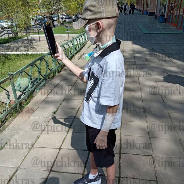 Мальчику, пострадавшему при нападении хаски в Сочи, провели операцию по восстановлению носа. - Краснодар | Телетайп, 14.07.2025