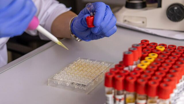 Эти исследования выявляют онкологию на ранней стадии - Телекомпания ОТВ. Челябинское областное телевидение, 07.11.2025