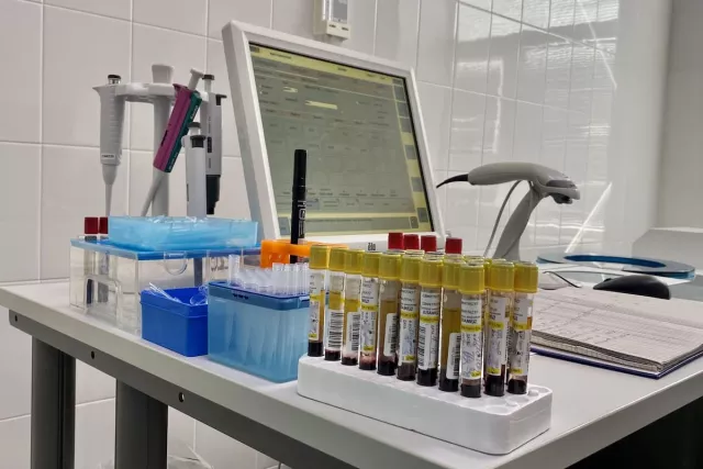 Минздрав Башкирии назвал главные причины появления бородавок на руках - Новости Уфы и Республики Башкортостан - UfaTime.ru, 21.02.2026