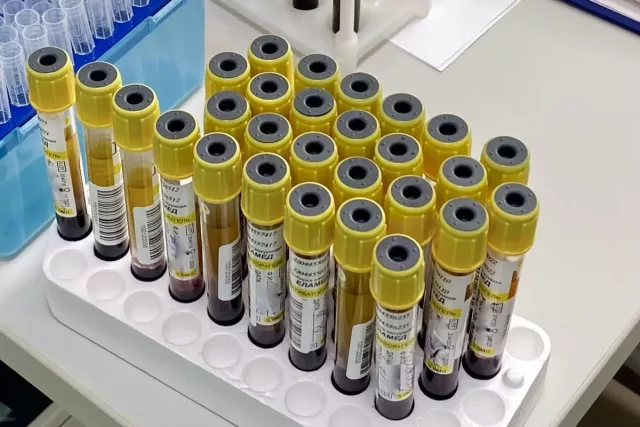 В Башкирии утвердили жесткие сроки для диагностики рака - Новости Уфы и Республики Башкортостан - UfaTime.ru, 24.04.2026