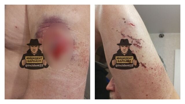 В Алтайском крае конфликт на дороге закончился стрельбой по дальнобойщику В Алтайском крае конфликт на дороге закончился стрельбой по дальнобойщику - ИА Амител, 27.10.2025