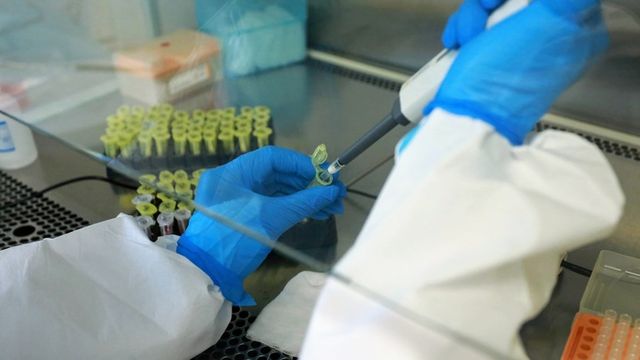 В России создали первый в мире тест на устойчивость бактерий к антибиотикам - ИА Амител, 21.09.2026