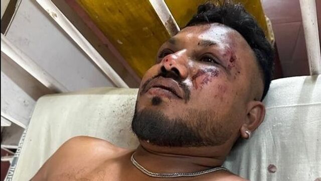 На борту самолета, который разбился в Индии, выжил один пассажир. Имя выжившего — Вишвашкумар Рамеш, ему 40 лет. Он отделался легкими травмами и после аварии сам встал на ноги. На борту самолета, который разбился в Индии, выжил один пассажир. Имя выжившего — Вишвашкумар Рамеш, ему 40 лет. Он отделался легкими травмами и после аварии сам встал на ноги. - Круглосуточные новости Екатеринбурга E1.RU, 12.06.2025