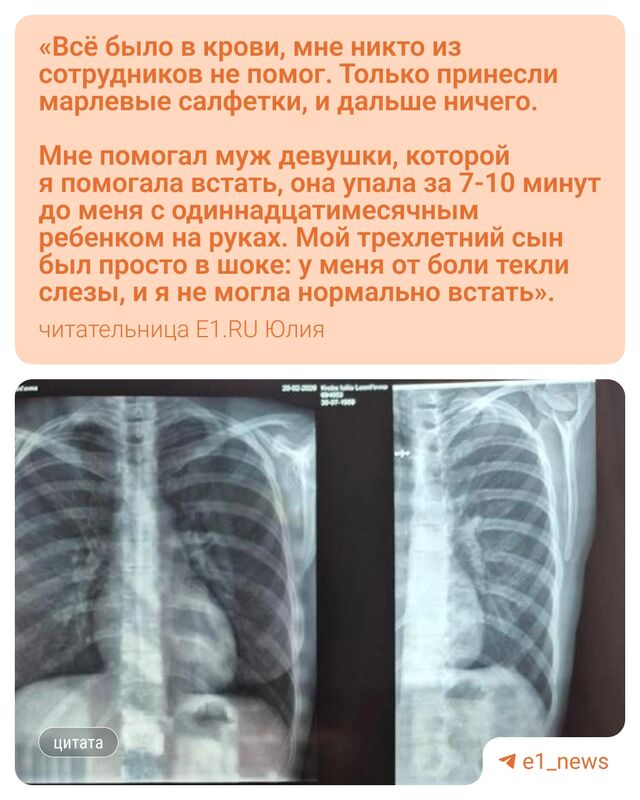 Екатеринбурженка сломала ребро, поскользнувшись на ступенях Екатеринбурженка сломала ребро, поскользнувшись на ступенях - Круглосуточные новости Екатеринбурга E1.RU, 24.02.2026