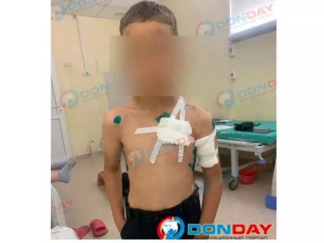 В Ростовской области напавшего на ребенка волка усыпили - Новости Ростова|DonDay, 18.09.2025