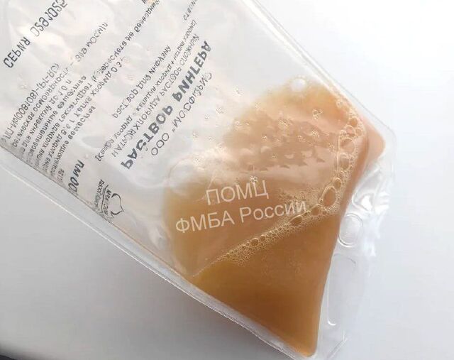 Нижегородские медики впервые очистили кровь от «плохого» холестерина, чтобы спасти пациента от неминуемого инфаркта или инсульта. Нижегородские медики впервые очистили кровь от «плохого» холестерина, чтобы спасти пациента от неминуемого инфаркта или инсульта. - Нижегородская правда | Нижний Новгород, 24.02.2026