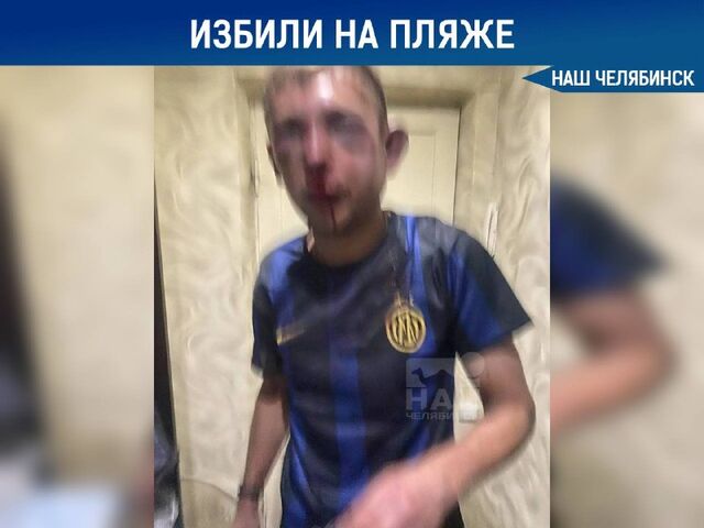 Челябинец попал в больницу после нападения на пляже - Наш Челябинск, 21.06.2026