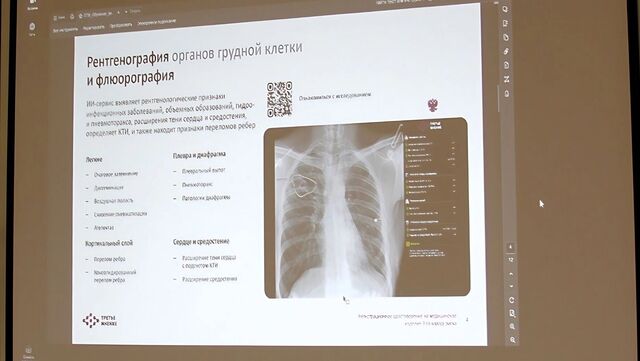 Искусственный интеллект пришёл на помощь хабаровским рентгенологам - Новости Хабаровска | transsibinfo.com, 18.03.2025