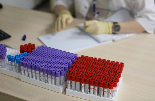 Минздрав Приморья: завозные случаи заболеваемости корью фиксируются в крае Минздрав Приморья: завозные случаи заболеваемости корью фиксируются в крае - Пресс-поток - Приморье24 Информационное агентство, последние новости Владивостока и Приморского края, 30.06.2025